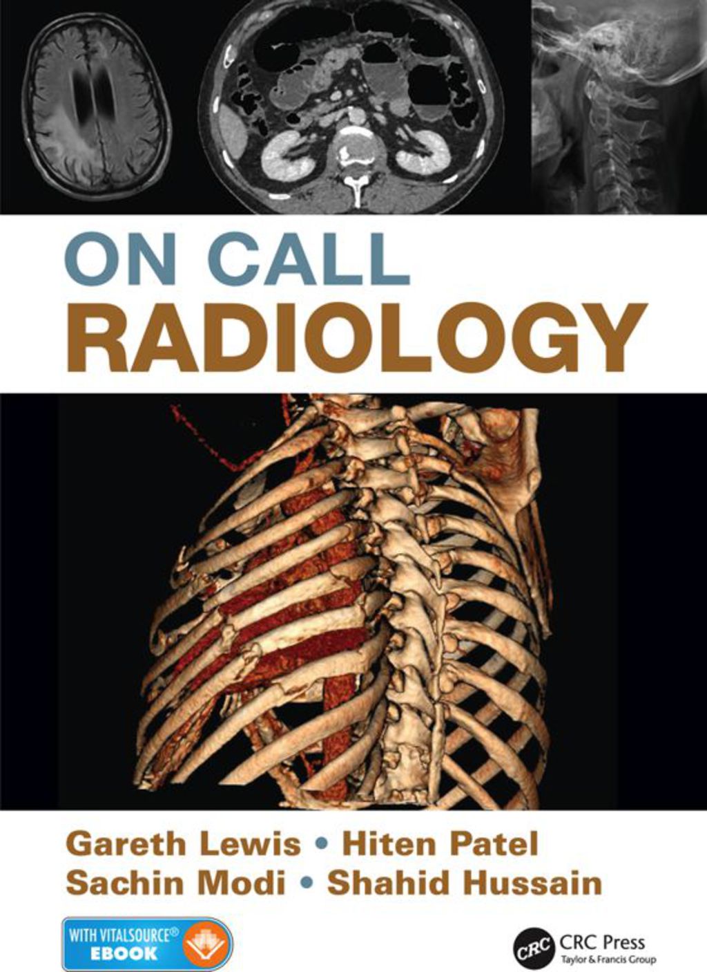 On Call Radiology 1st Edition â€“ PDF/EPUB Version Downloadable