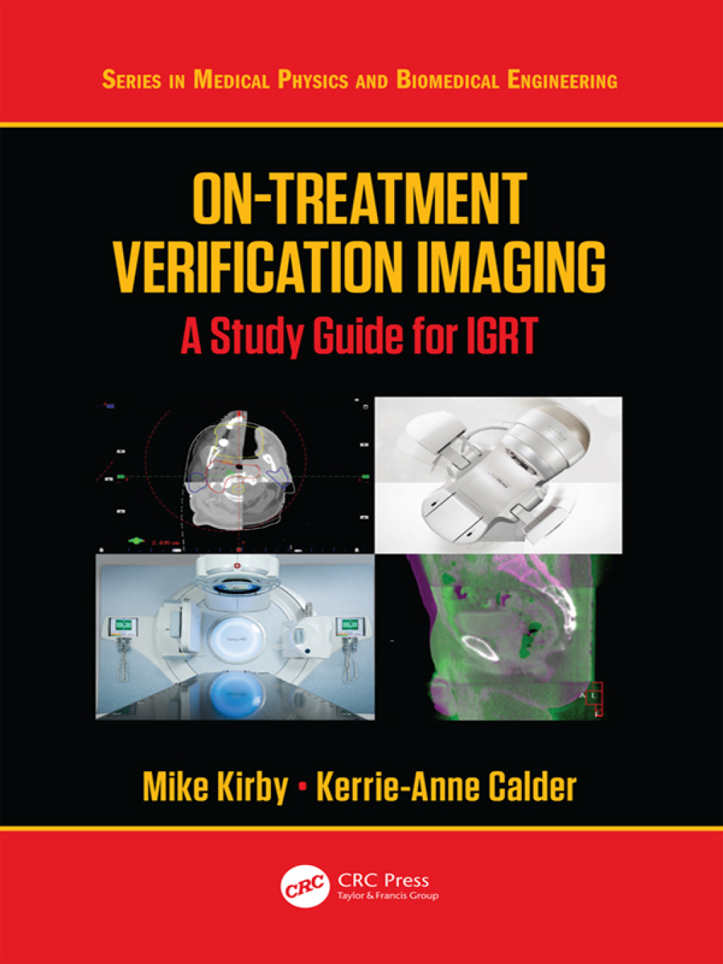 On-Treatment Verification Imaging A Study Guide for IGRT 1st Edition â€“ PDF/EPUB Version Downloadable