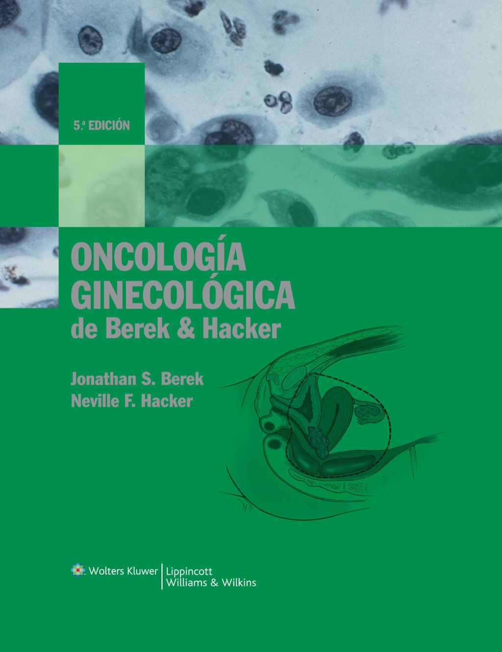 OncologÃ­a ginecolÃ³gica de Berek & Hacker, 5.Âª ediciÃ³n 5th Edition â€“ PDF/EPUB Version Downloadable