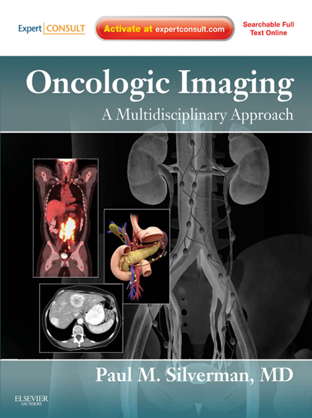 Oncologic Imaging: A Multidisciplinary Approach 1st Edition â€“ PDF/EPUB Version Downloadable