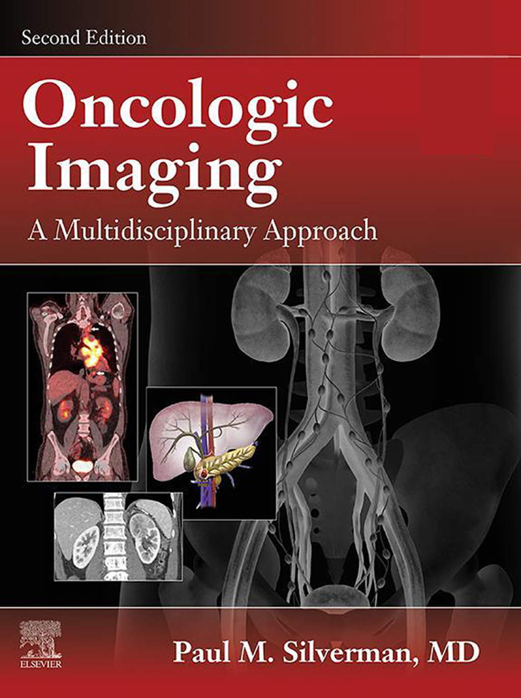 Oncologic Imaging: A Multidisciplinary Approach E-Book 2nd Edition â€“ PDF/EPUB Version Downloadable