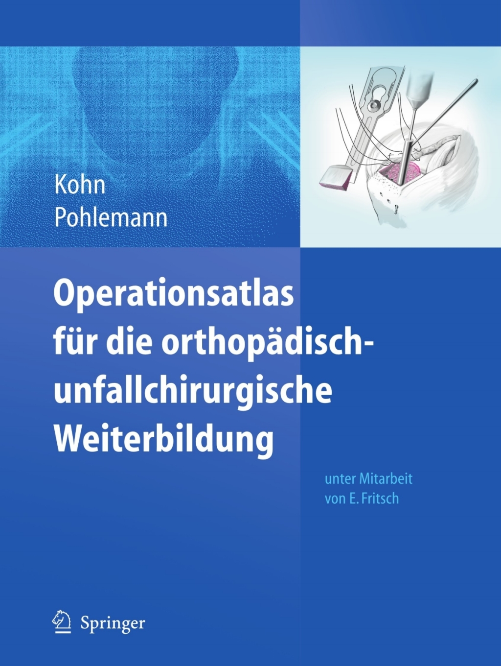 Operationsatlas fÃ¼r die orthopÃ¤disch-unfallchirurgische Weiterbildung  â€“ PDF/EPUB Version Downloadable