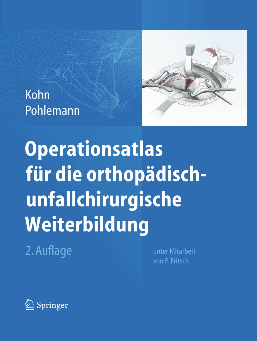 Operationsatlas fÃ¼r die orthopÃ¤disch-unfallchirurgische Weiterbildung 2nd Edition â€“ PDF/EPUB Version Downloadable