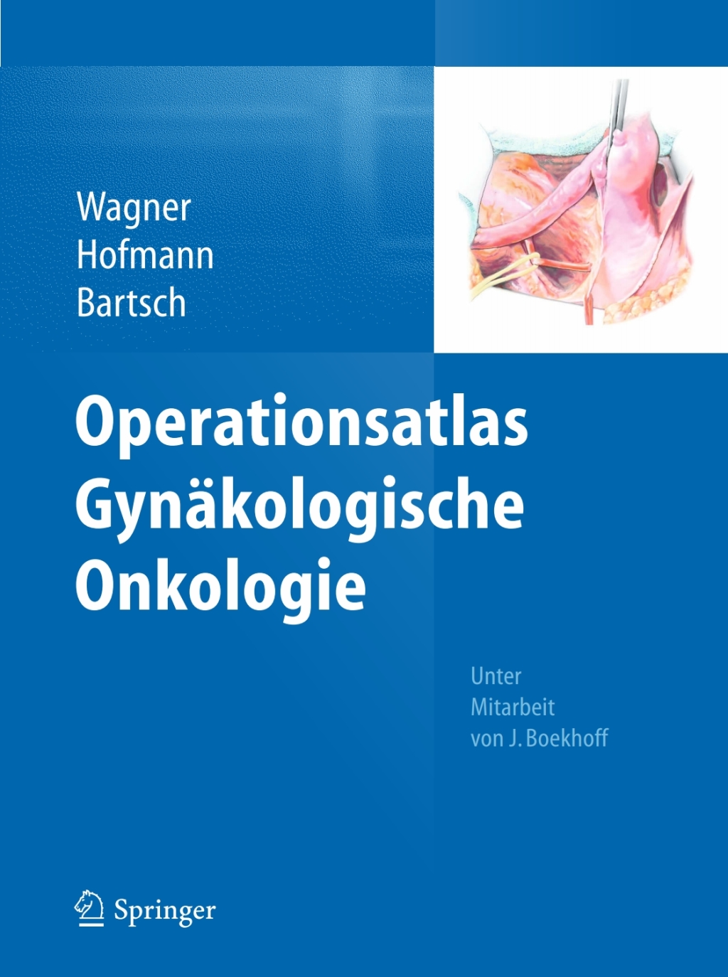 Operationsatlas GynÃ¤kologische Onkologie  â€“ PDF/EPUB Version Downloadable
