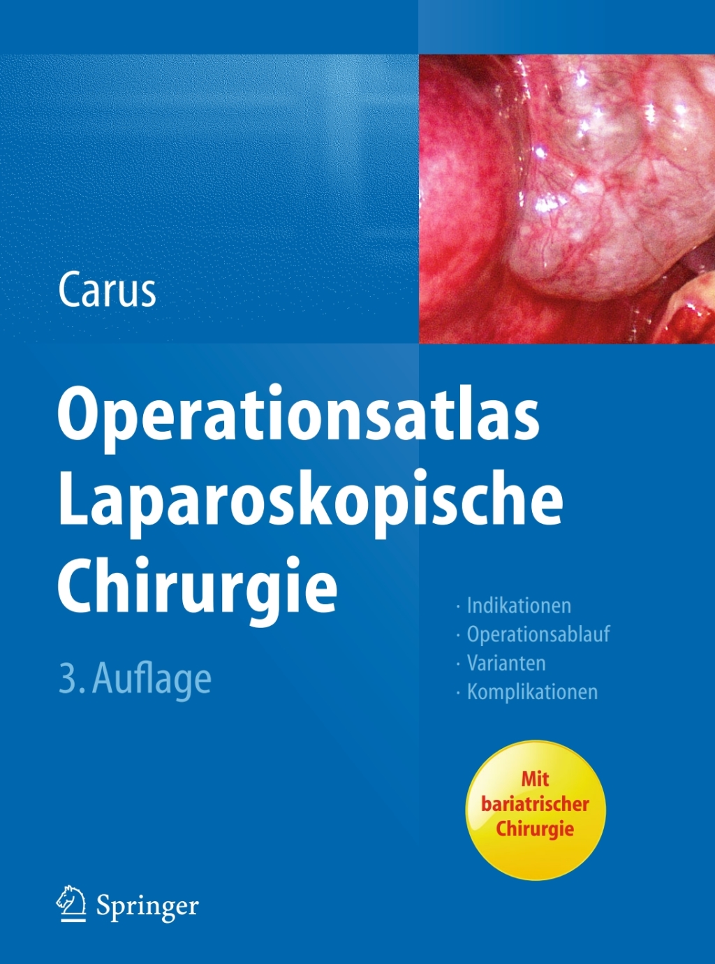 Operationsatlas Laparoskopische Chirurgie Indikationen - Operationsablauf - Varianten - Komplikationen 3rd Edition â€“ PDF/EPUB Version Downloadable