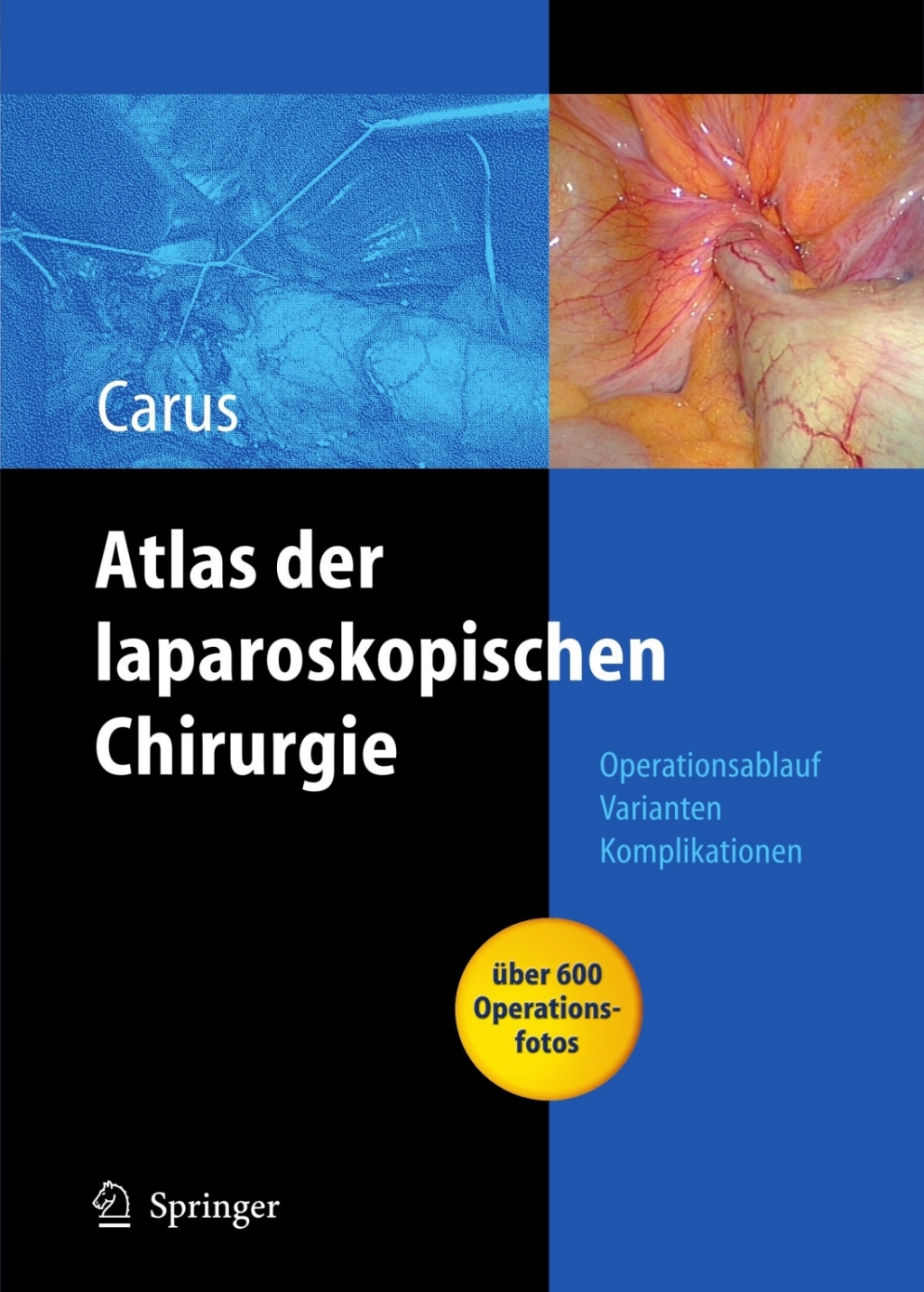 Operationsatlas Laparoskopische Chirurgie Indikationen - Operationsablauf - Varianten - Komplikationen Mit Single Access Surgery  â€“ PDF/EPUB Version Downloadable