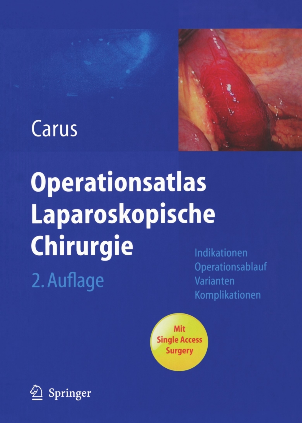Operationsatlas Laparoskopische Chirurgie Indikationen - Operationsablauf - Varianten - Komplikationen Mit Single Access Surgery 2nd Edition â€“ PDF/EPUB Version Downloadable