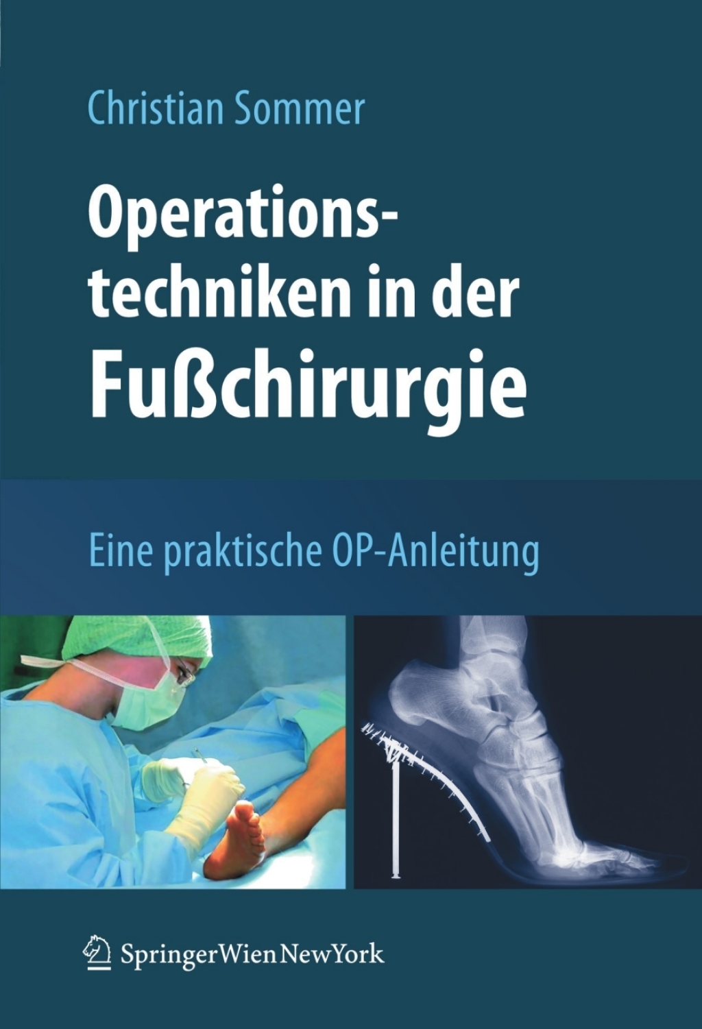 Operationstechniken in der FuÃŸchirurgie Eine praktische OP-Anleitung  â€“ PDF/EPUB Version Downloadable