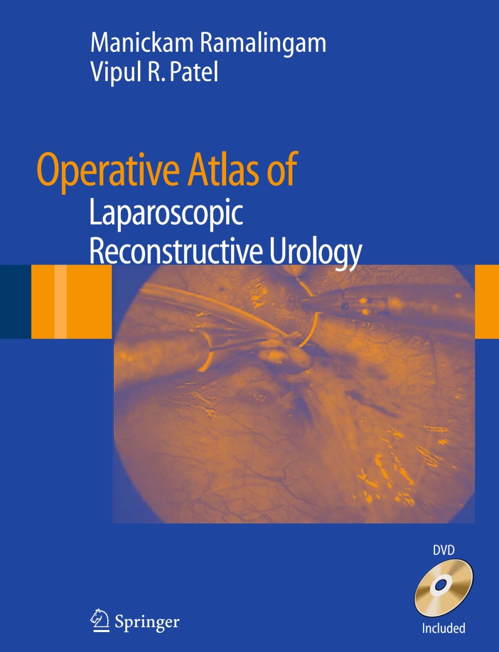Operative Atlas of Laparoscopic Reconstructive Urology 1st Edition â€“ PDF/EPUB Version Downloadable