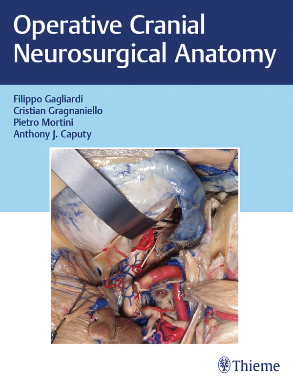 Operative Cranial Neurosurgical Anatomy 1st Edition â€“ PDF/EPUB Version Downloadable