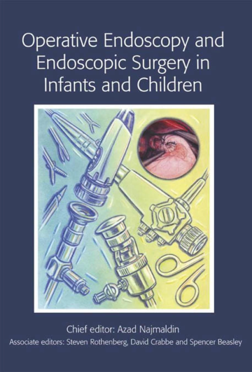 Operative Endoscopy and Endoscopic Surgery in Infants and Children 1st Edition â€“ PDF/EPUB Version Downloadable