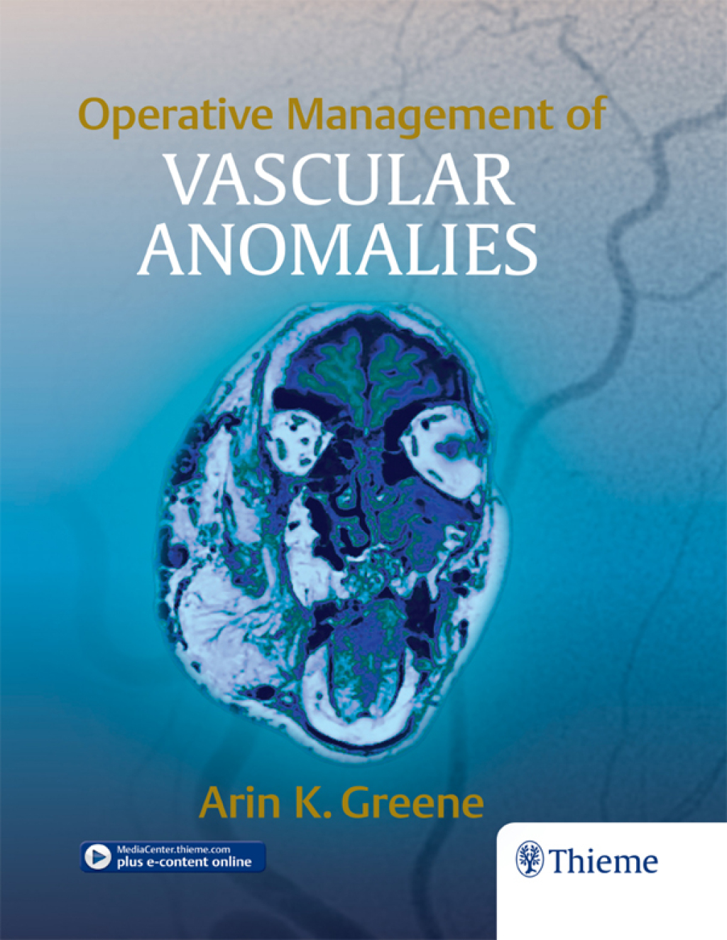 Operative Management of Vascular Anomalies 1st Edition â€“ PDF/EPUB Version Downloadable