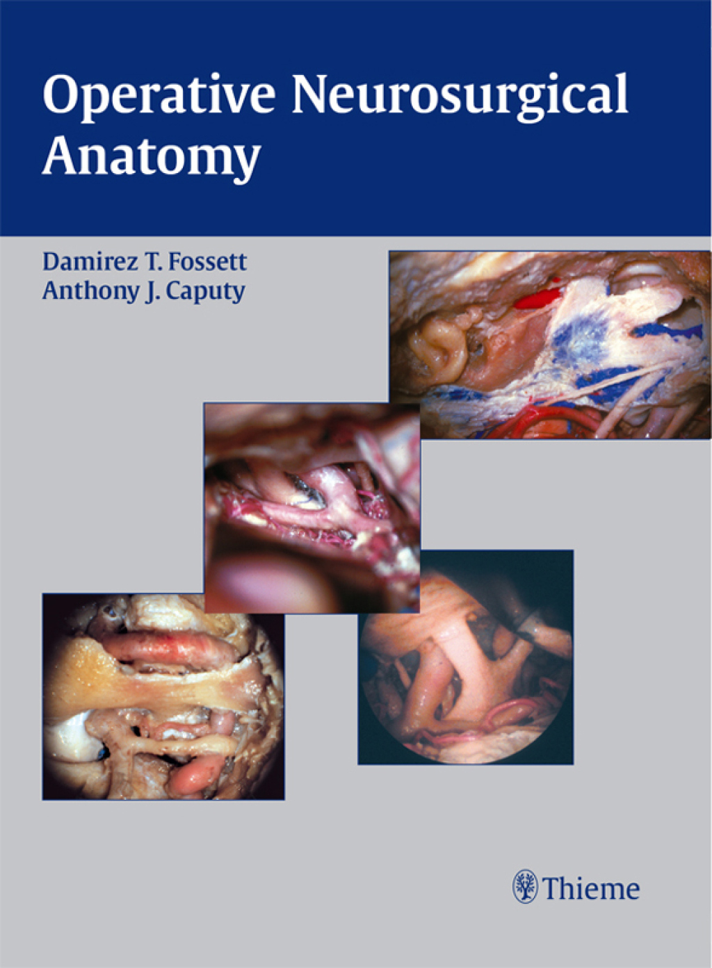 Operative Neurosurgical Anatomy 1st Edition â€“ PDF/EPUB Version Downloadable