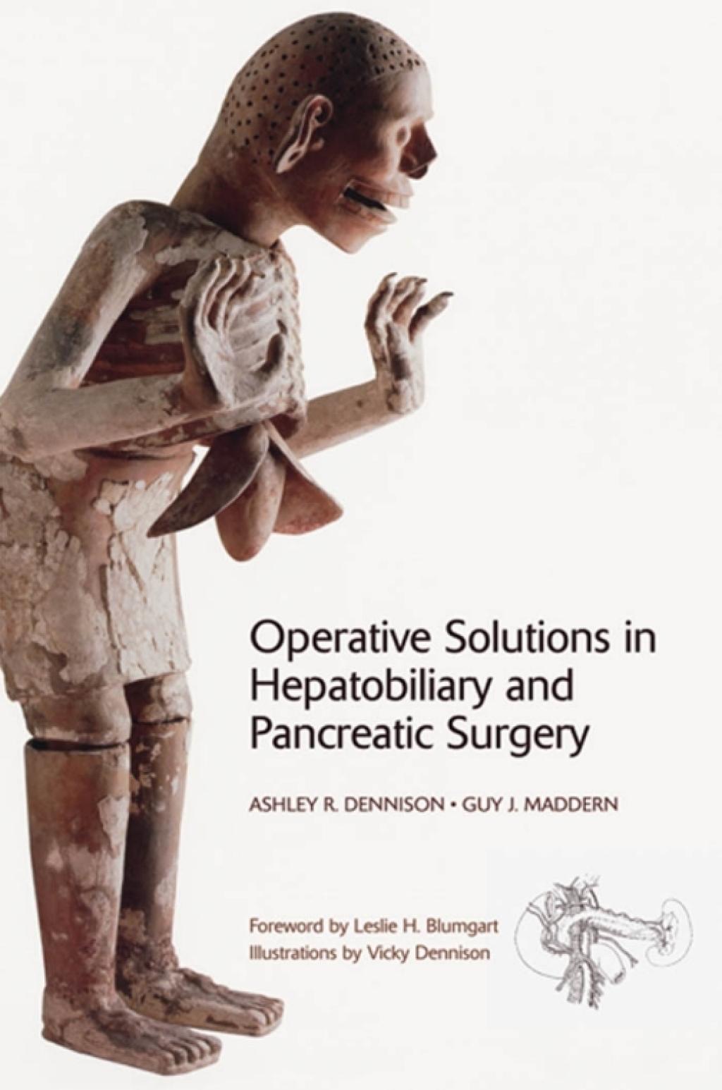 Operative Solutions in Hepatobiliary and Pancreatic Surgery  â€“ PDF/EPUB Version Downloadable