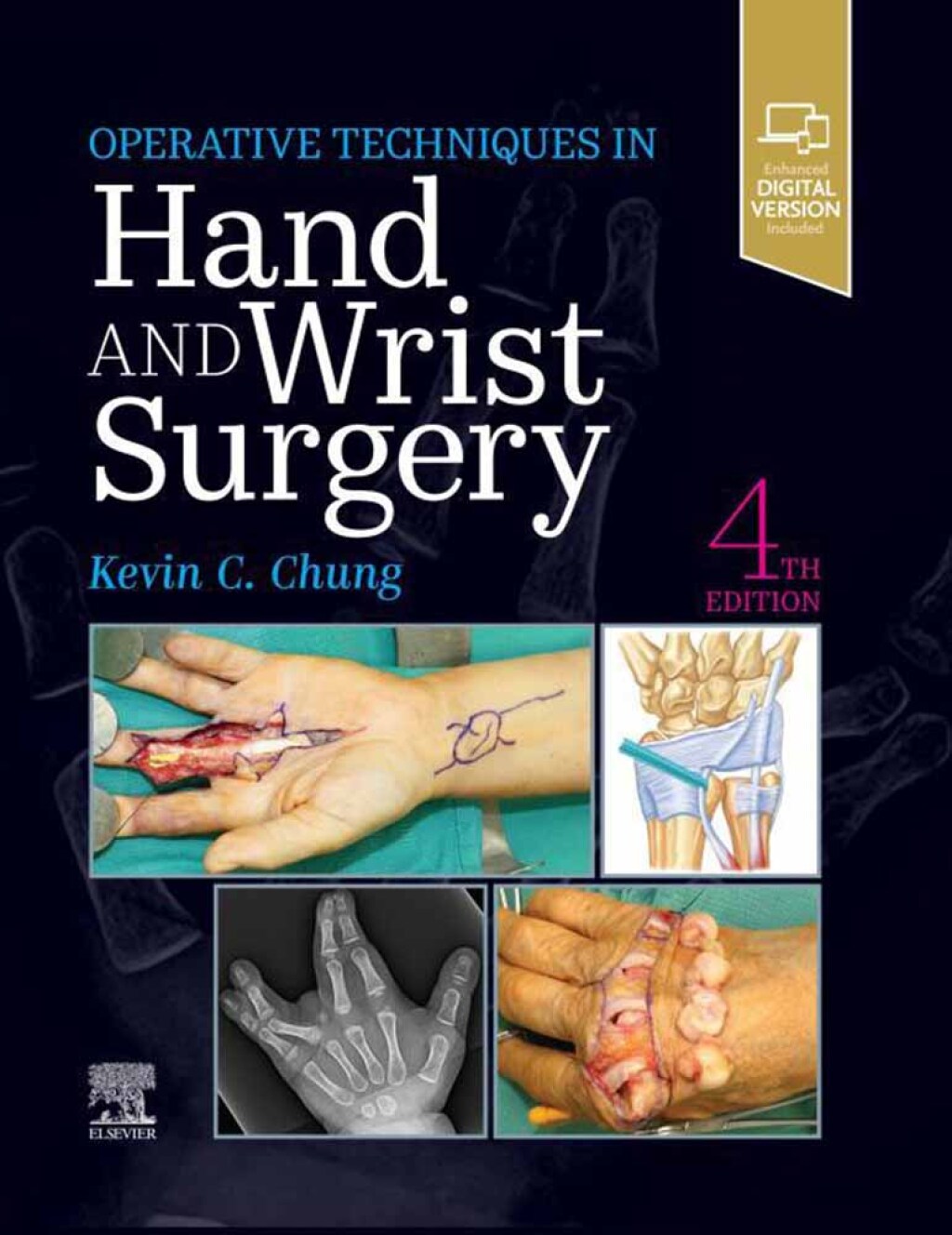 Operative Techniques: Hand and Wrist Surgery 4th Edition â€“ PDF/EPUB Version Downloadable