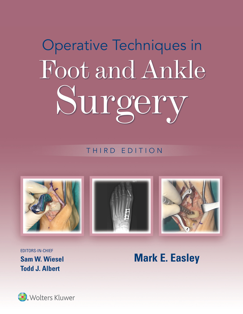 Operative Techniques in Foot and Ankle Surgery 3rd Edition â€“ PDF/EPUB Version Downloadable