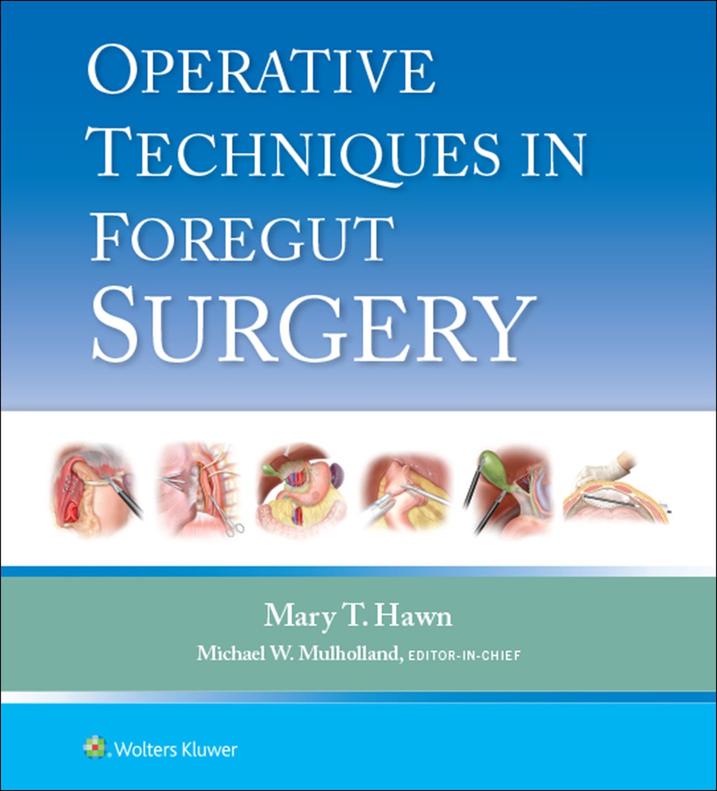 Operative Techniques in Foregut Surgery  â€“ PDF/EPUB Version Downloadable