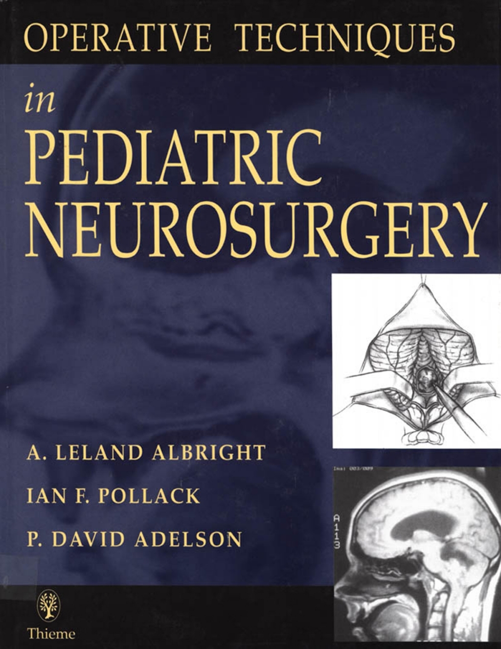 Operative Techniques in Pediatric Neurosurgery 1st Edition â€“ PDF/EPUB Version Downloadable