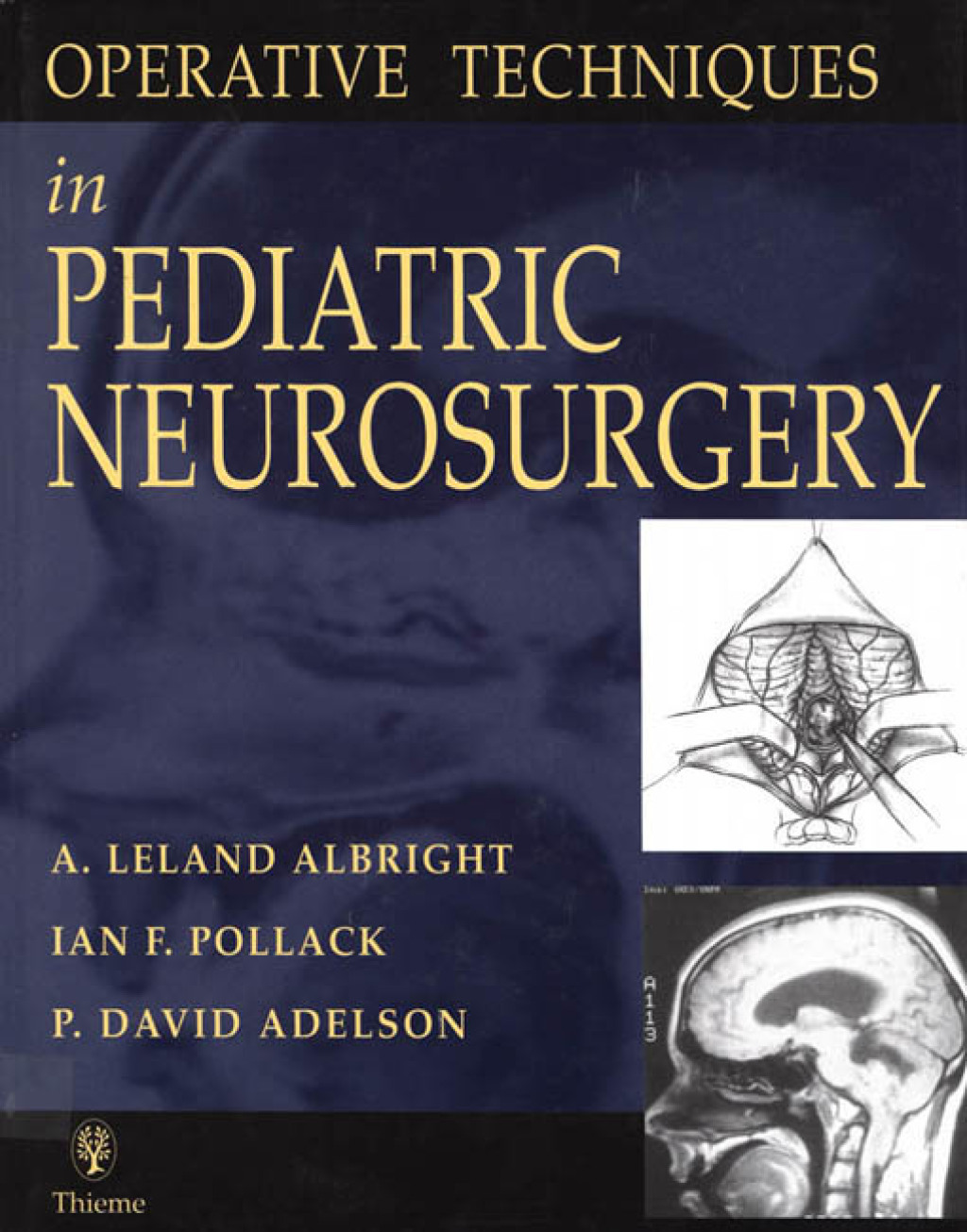 Operative Techniques in Pediatric Neurosurgery 1st Edition â€“ PDF/EPUB Version Downloadable