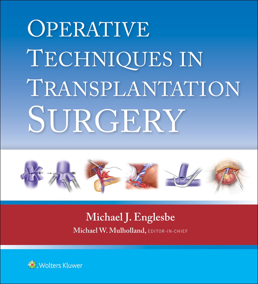 Operative Techniques in Transplantation Surgery  â€“ PDF/EPUB Version Downloadable