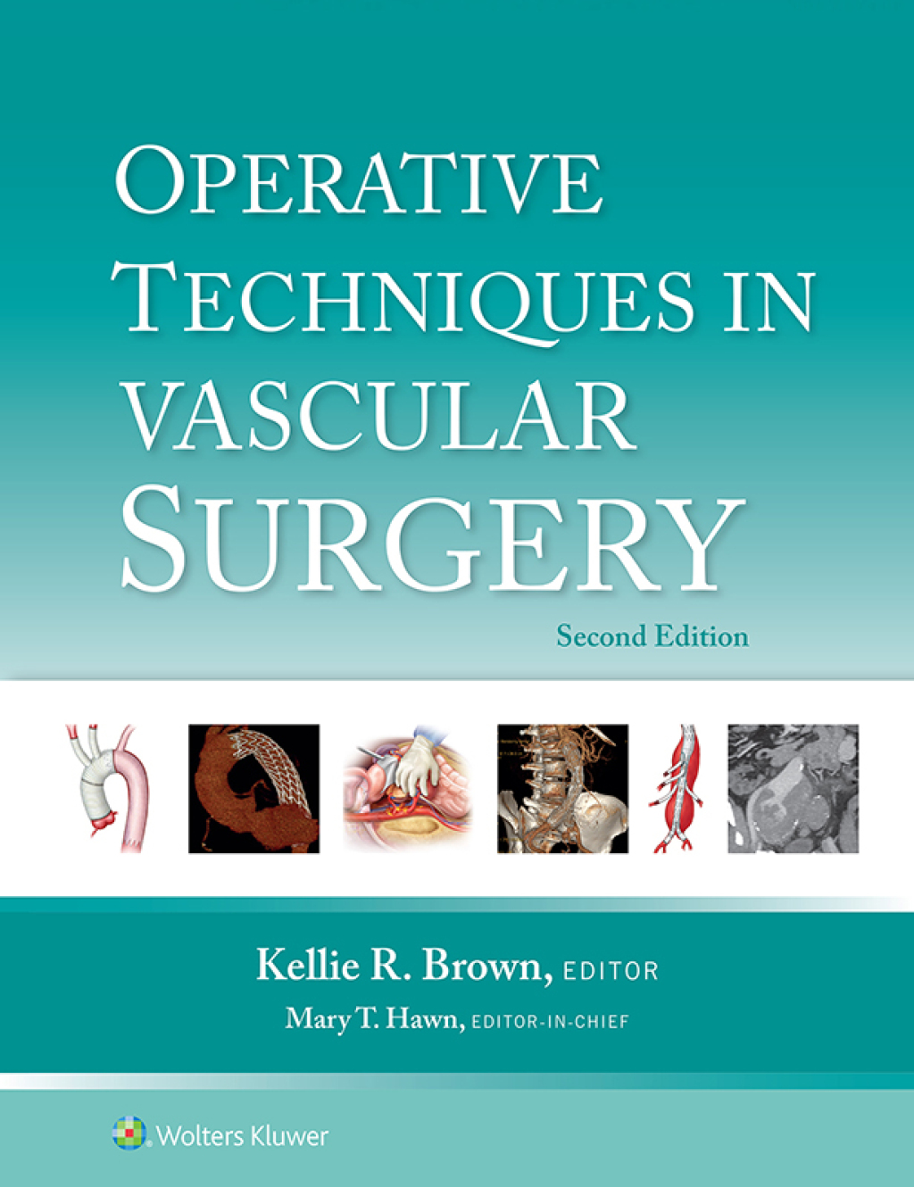 Operative Techniques in Vascular Surgery 2nd Edition â€“ PDF/EPUB Version Downloadable