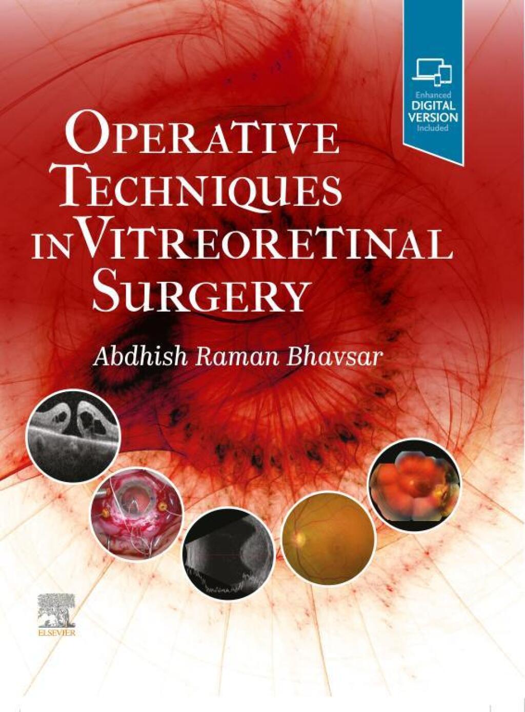 Operative Techniques in Vitreoretinal Surgery  â€“ PDF/EPUB Version Downloadable