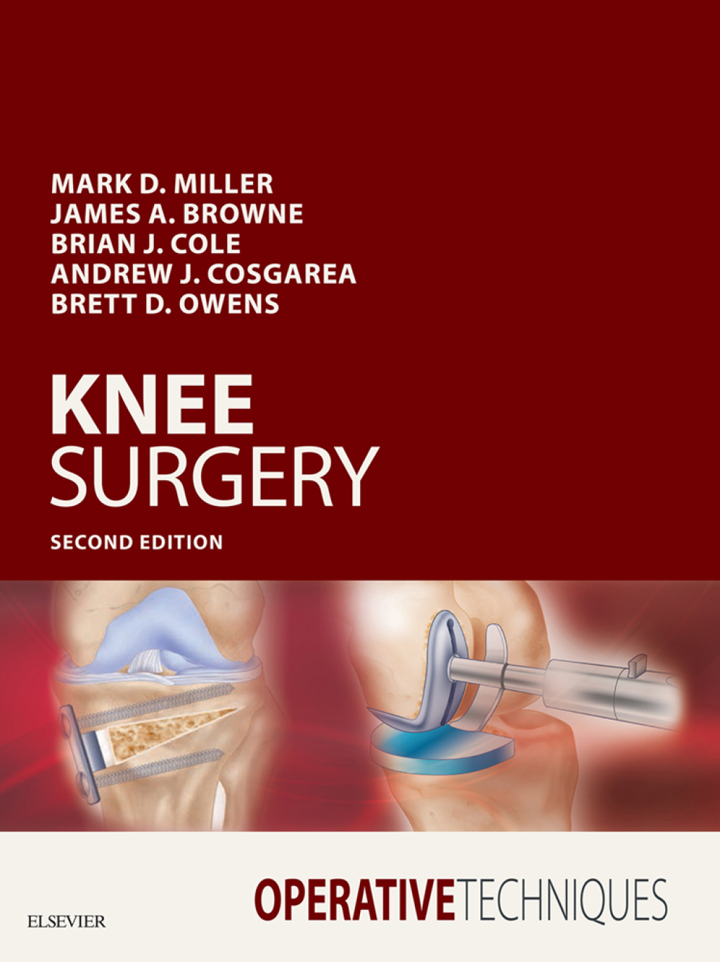 Operative Techniques: Knee Surgery 2nd Edition â€“ PDF/EPUB Version Downloadable