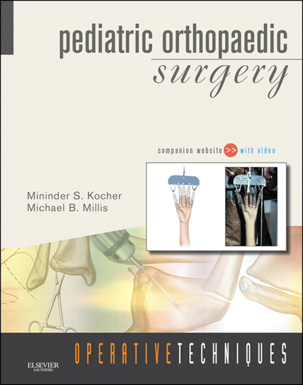 Operative Techniques: Pediatric Orthopaedic Surgery  â€“ PDF/EPUB Version Downloadable