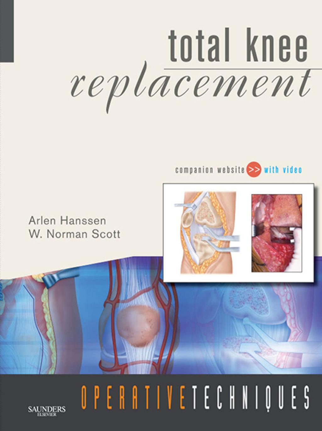 Operative Techniques: Total Knee Replacement - Electronic 1st Edition â€“ PDF/EPUB Version Downloadable