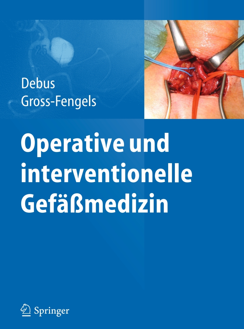Operative und interventionelle GefÃ¤ÃŸmedizin  â€“ PDF/EPUB Version Downloadable