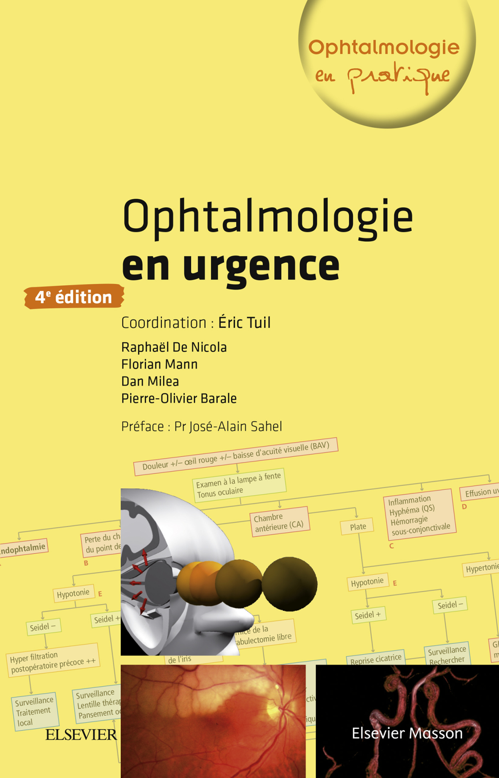 Ophtalmologie en urgence 4th Edition â€“ PDF/EPUB Version Downloadable