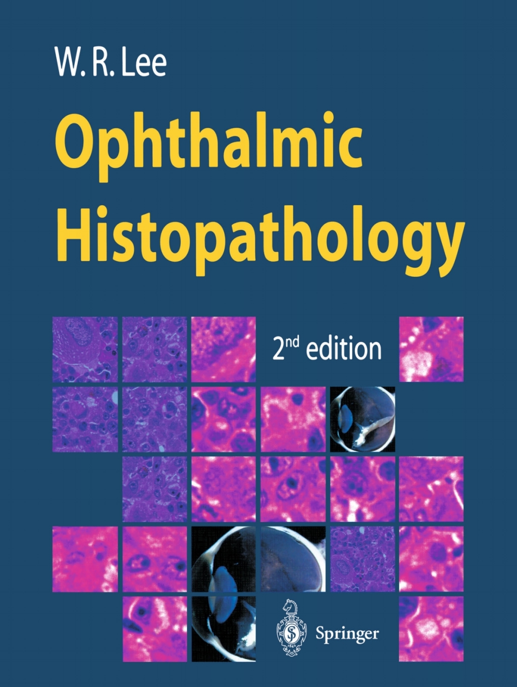 Ophthalmic Histopathology 2nd Edition â€“ PDF/EPUB Version Downloadable