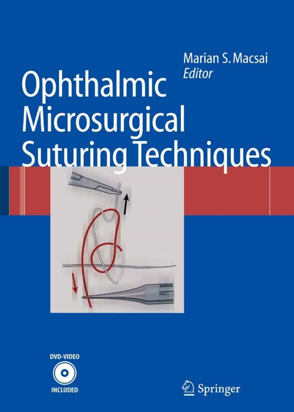 Ophthalmic Microsurgical Suturing Techniques 1st Edition â€“ PDF/EPUB Version Downloadable