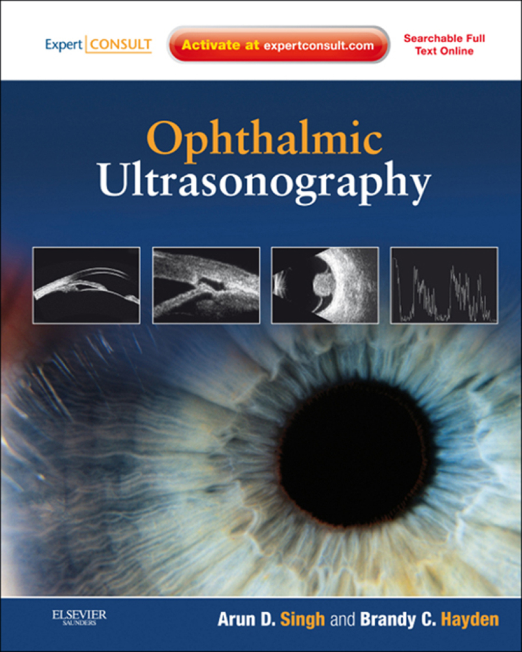 Ophthalmic Ultrasonography  â€“ PDF/EPUB Version Downloadable