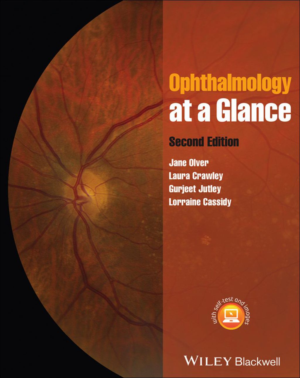 Ophthalmology at a Glance 2nd Edition â€“ PDF/EPUB Version Downloadable