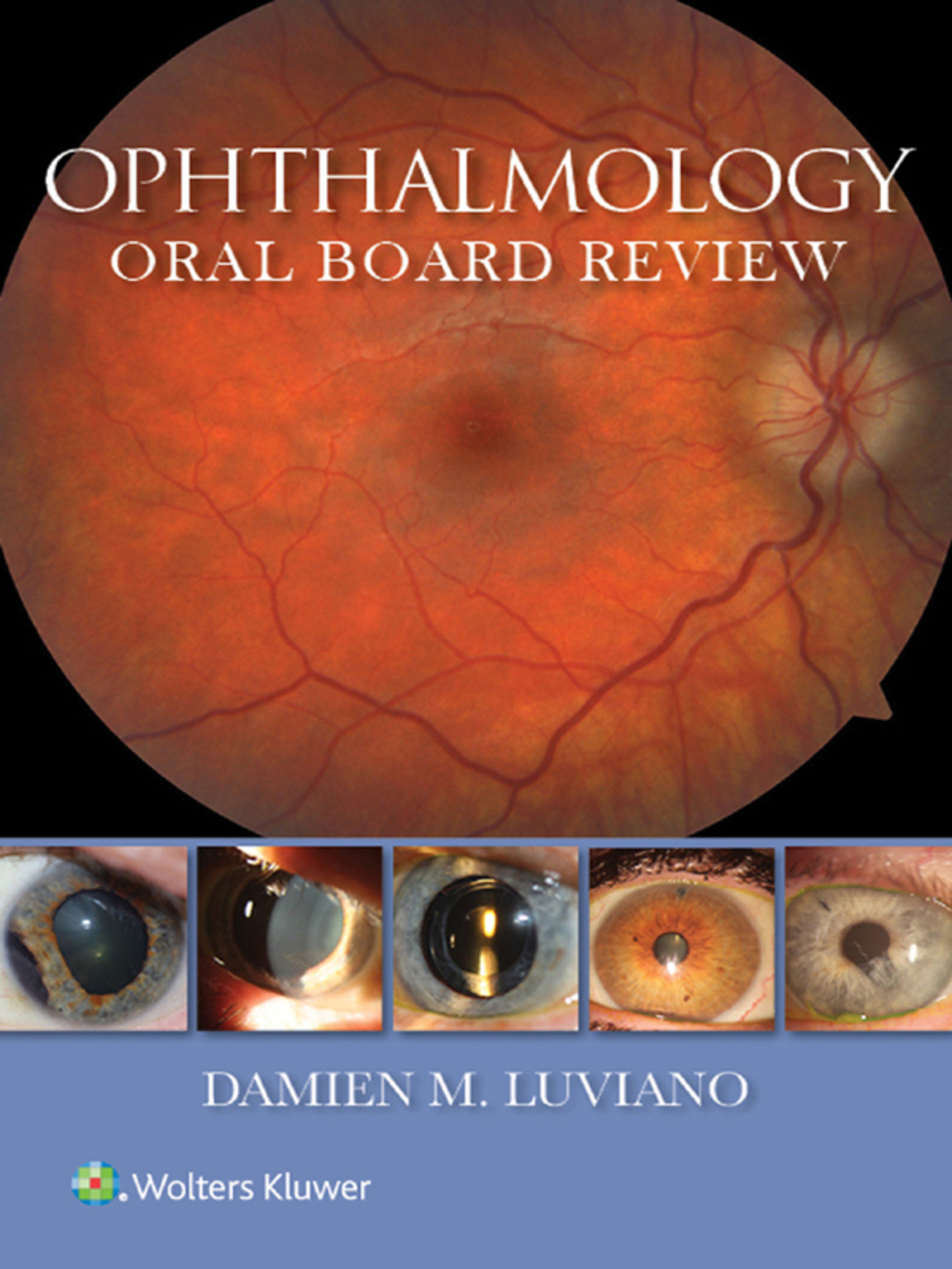 Ophthalmology Oral Board Review  â€“ PDF/EPUB Version Downloadable