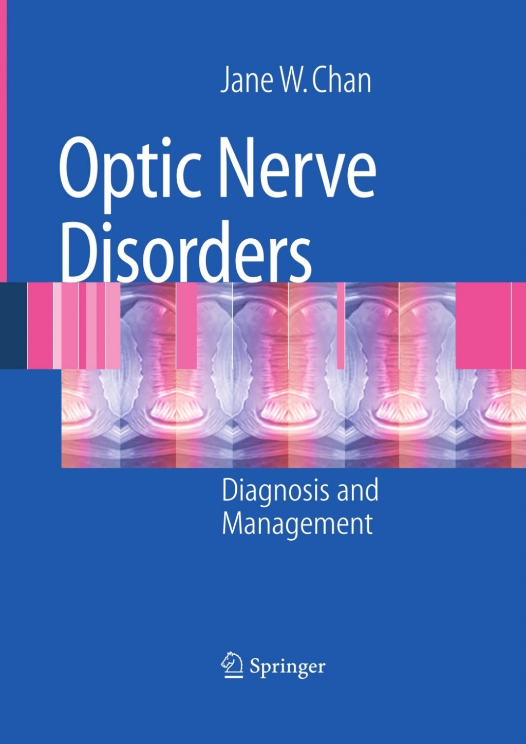 Optic Nerve Disorders Diagnosis and Management  â€“ PDF/EPUB Version Downloadable