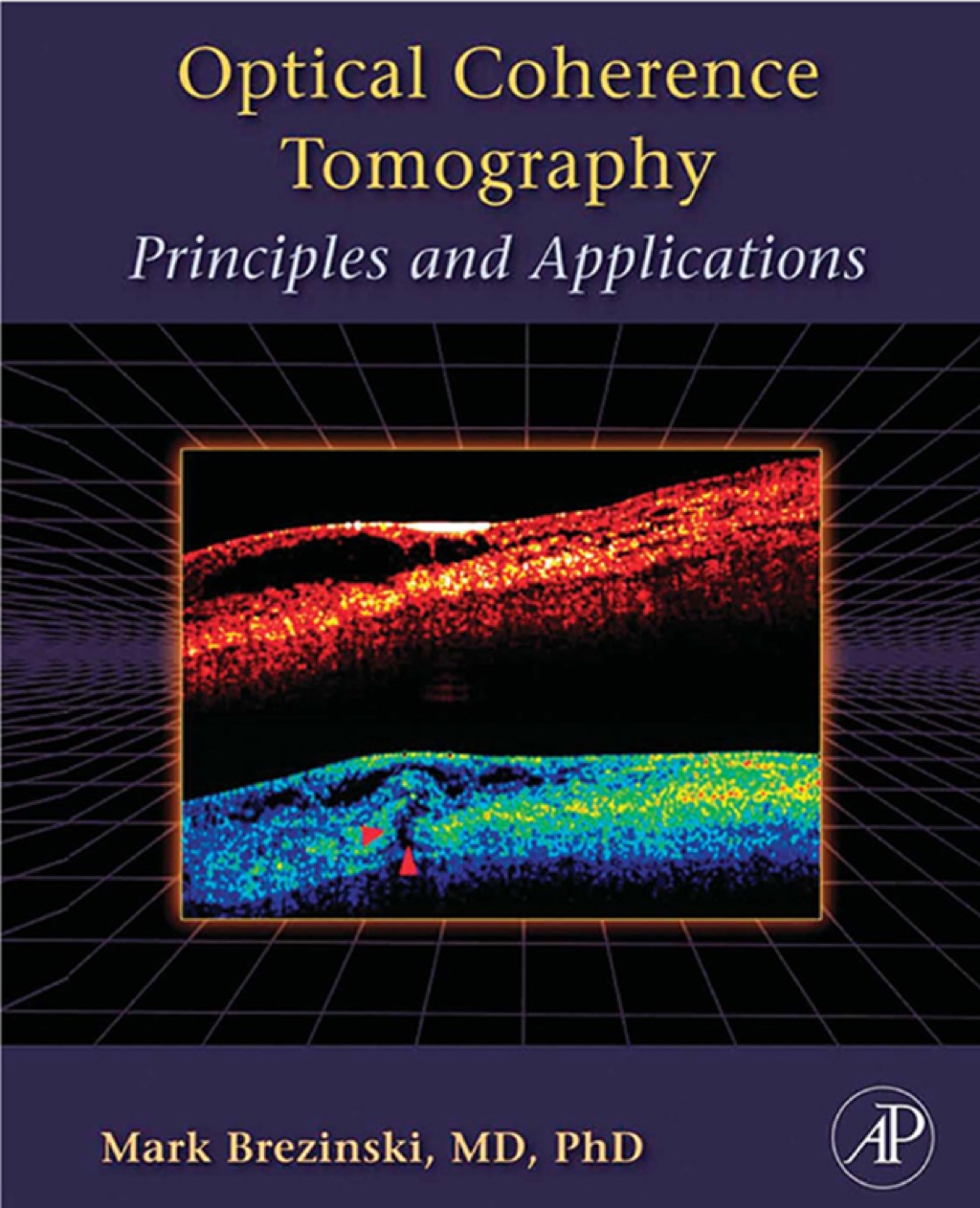 Optical Coherence Tomography  â€“ PDF/EPUB Version Downloadable