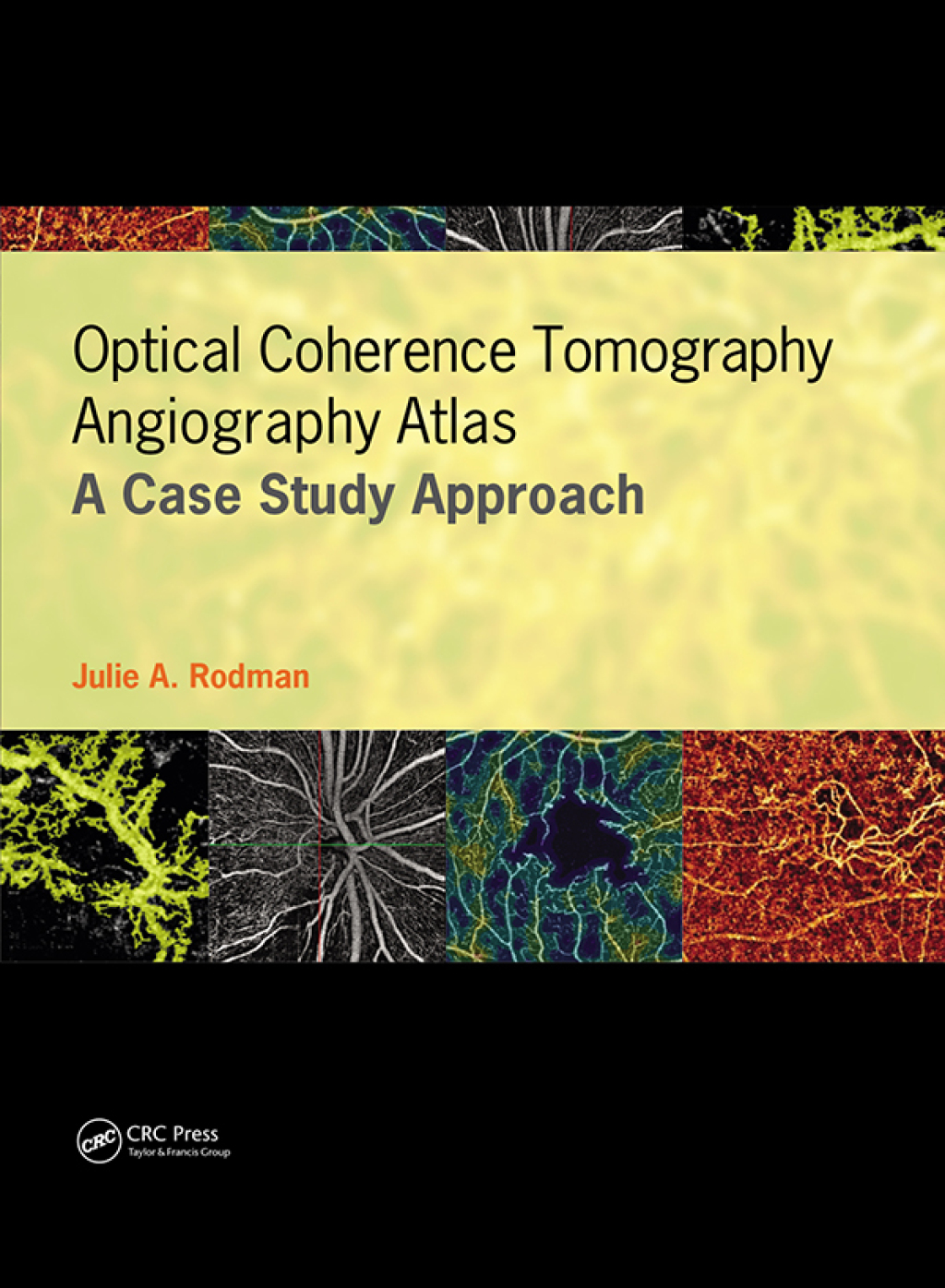 Optical Coherence Tomography Angiography Atlas A Case Study Approach 1st Edition â€“ PDF/EPUB Version Downloadable