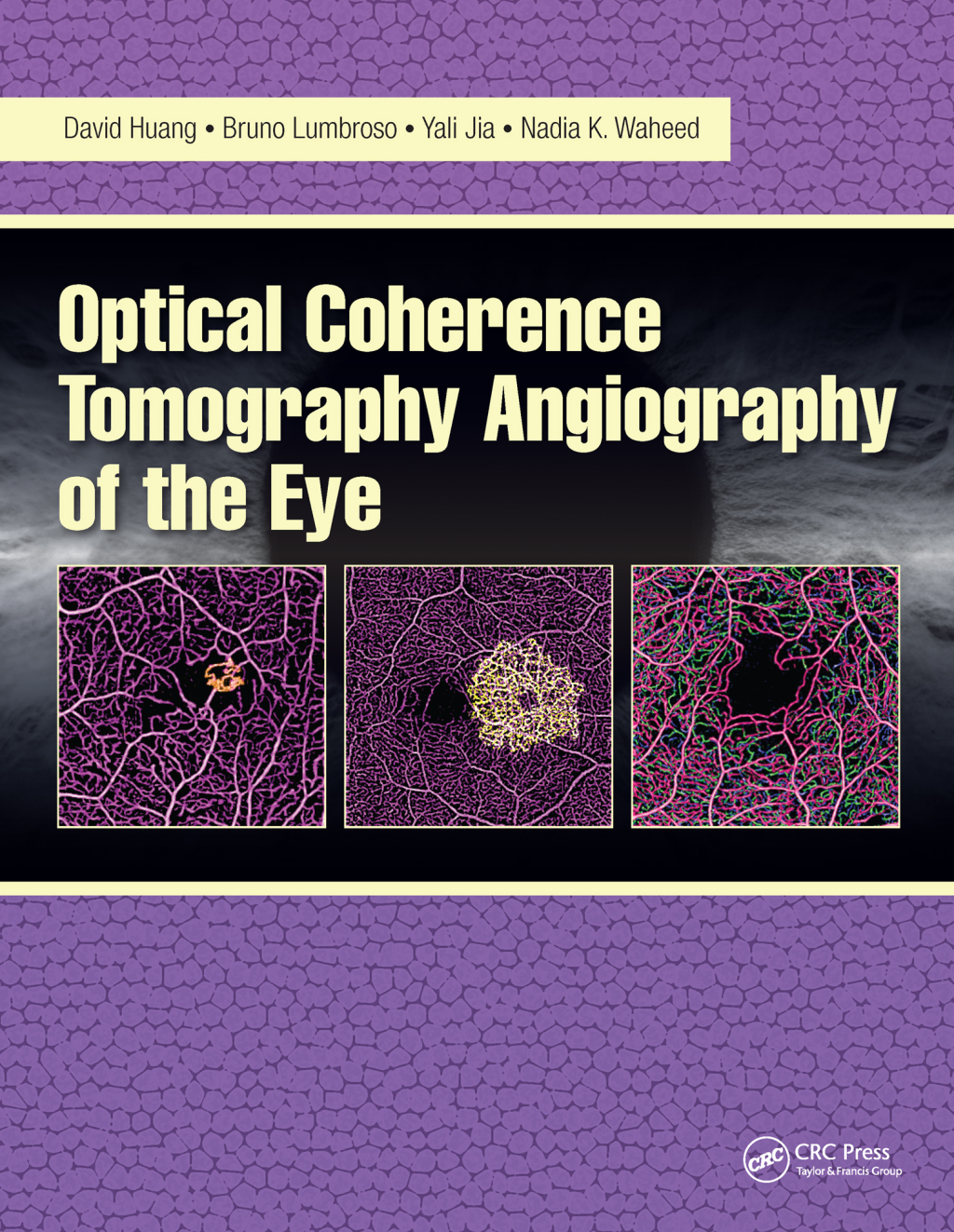 Optical Coherence Tomography Angiography of the Eye OCT Angiography 1st Edition â€“ PDF/EPUB Version Downloadable