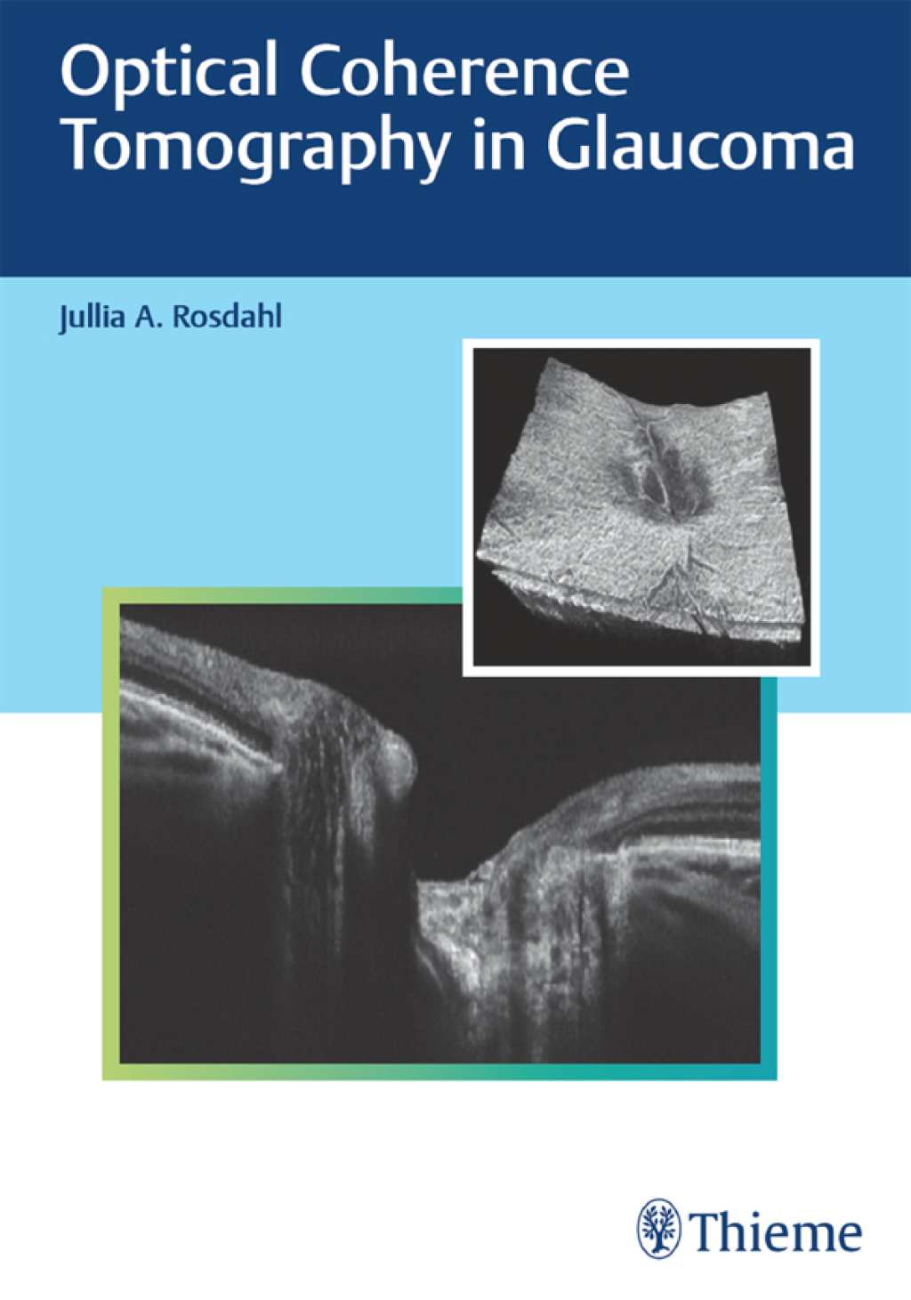 Optical Coherence Tomography in Glaucoma 1st Edition â€“ PDF/EPUB Version Downloadable