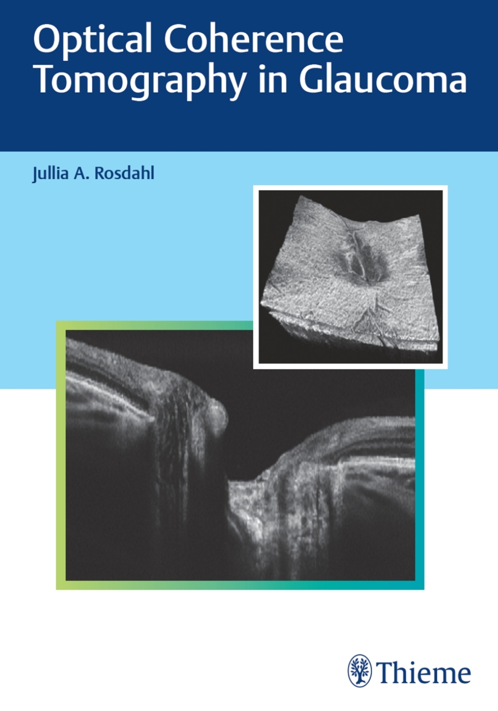 Optical Coherence Tomography in Glaucoma 1st Edition â€“ PDF/EPUB Version Downloadable