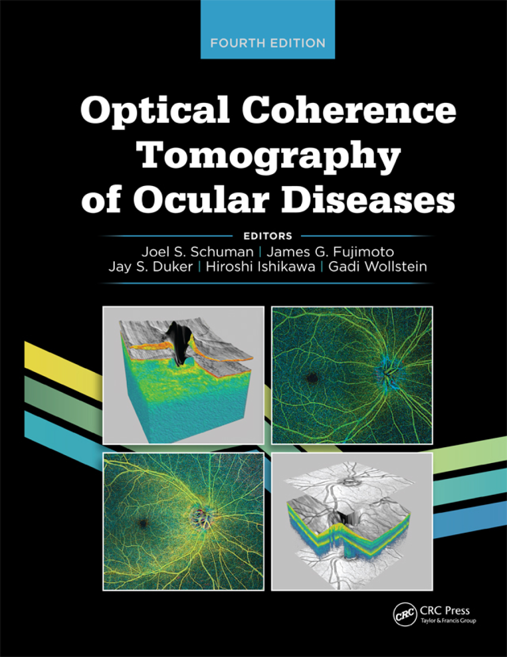 Optical Coherence Tomography of Ocular Diseases 4th Edition â€“ PDF/EPUB Version Downloadable