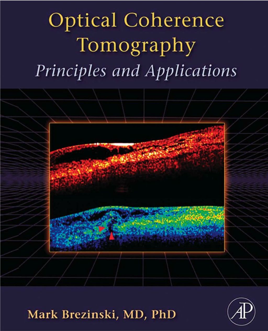 Optical Coherence Tomography: Principles and Applications  â€“ PDF/EPUB Version Downloadable