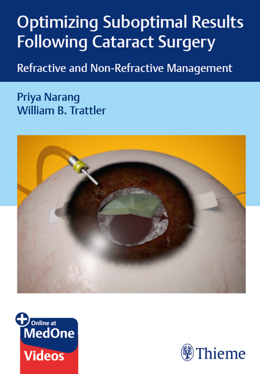 Optimizing Suboptimal Results Following Cataract Surgery Refractive and Non-Refractive Management 1st Edition â€“ PDF/EPUB Version Downloadable
