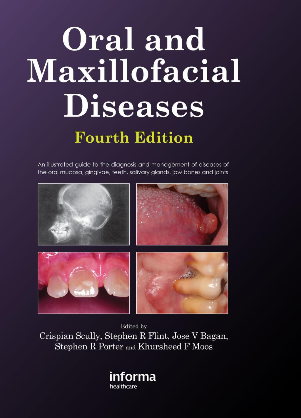 Oral and Maxillofacial Diseases 4th Edition â€“ PDF/EPUB Version Downloadable