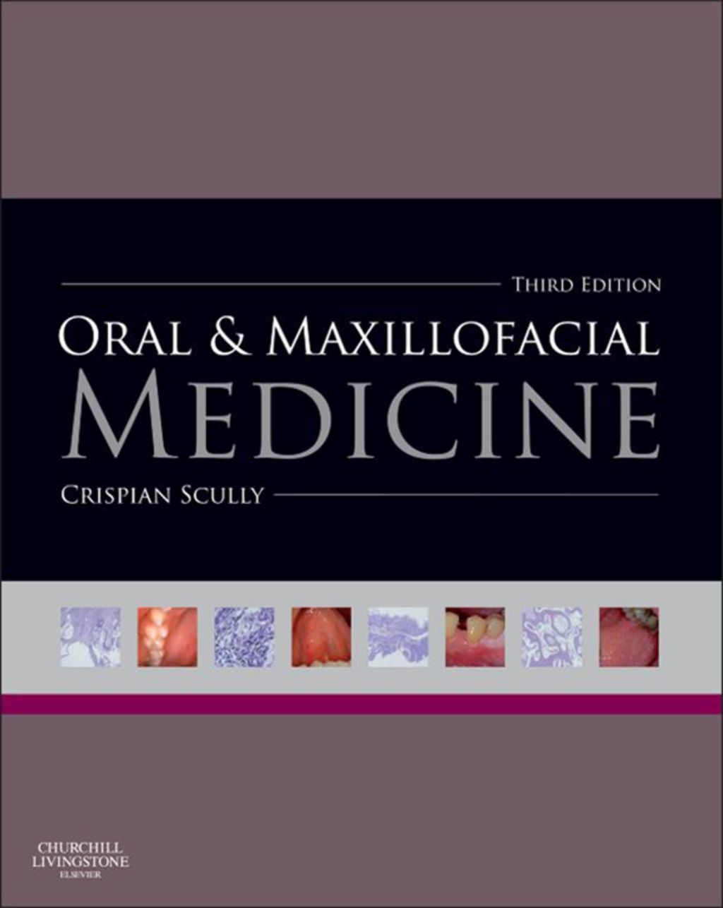 Oral and Maxillofacial Medicine The Basis of Diagnosis and Treatment 3rd Edition â€“ PDF/EPUB Version Downloadable