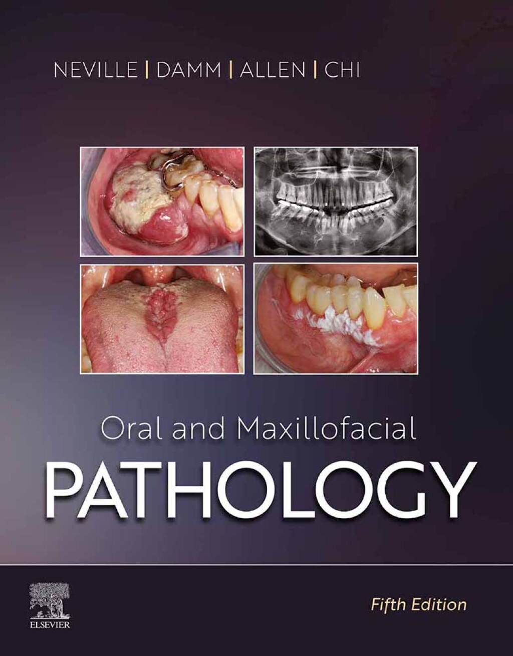 Oral and Maxillofacial Pathology 5th Edition â€“ PDF/EPUB Version Downloadable