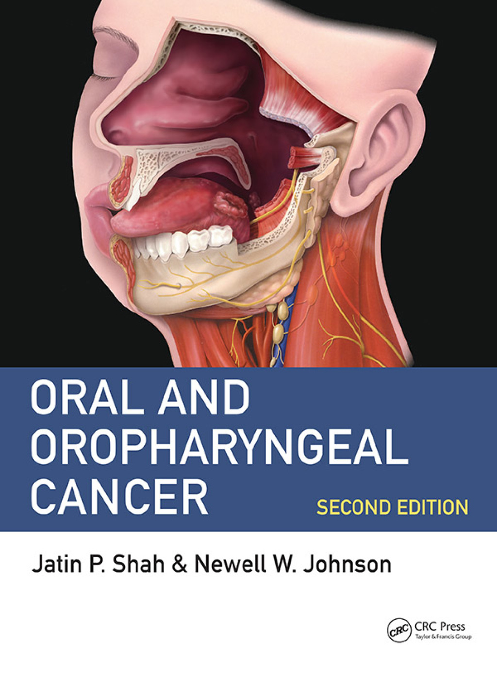 Oral and Oropharyngeal Cancer 2nd Edition â€“ PDF/EPUB Version Downloadable