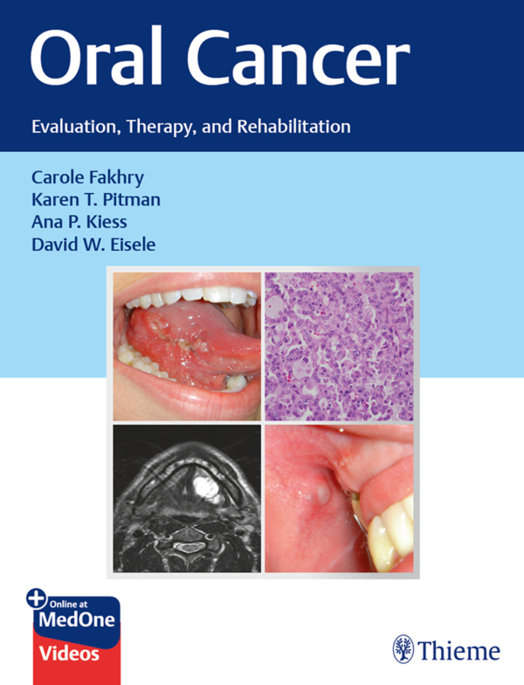 Oral Cancer Evaluation, Therapy, and Rehabilitation 1st Edition â€“ PDF/EPUB Version Downloadable